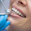 What is the Difference Between a General Dentist and an Orthodontist?
