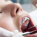Are You Eligible for Maintaining Your Orthodontic Certification in Your State?