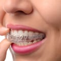 What are the Consequences of Skipping Orthodontic Appointments?