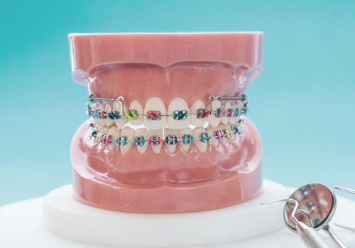 What Experience is Needed to Maintain Orthodontist Certification?