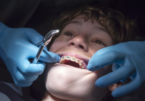 How Long Does it Take to Become an Orthodontist?