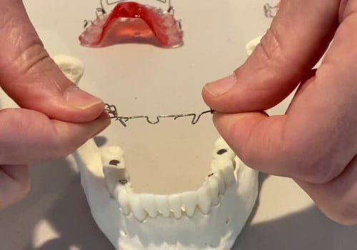 Why Orthodontists Don't Pull Teeth Anymore