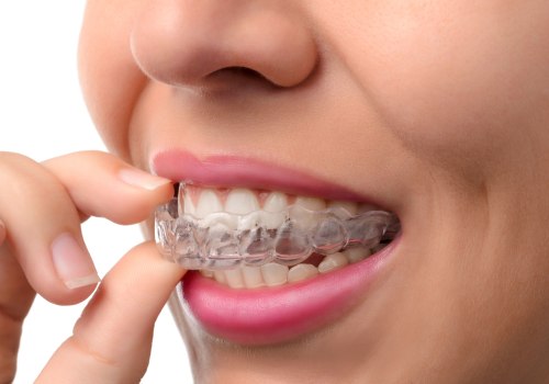 What are the Consequences of Skipping Orthodontic Appointments?